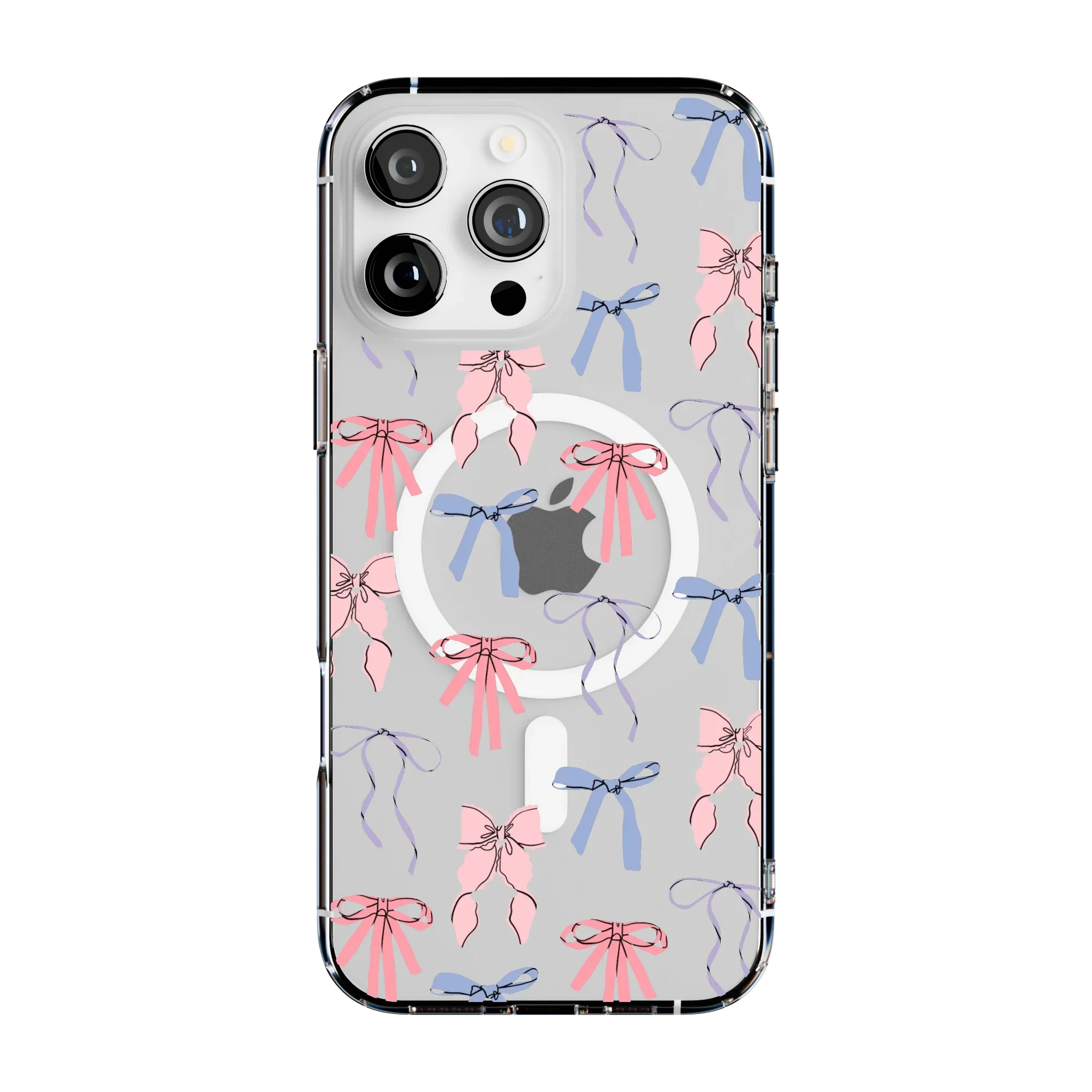 Coquette Girlie | Pastel Bows Case